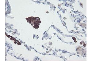 Image no. 2 for anti-Snail Family Zinc Finger 2 (SNAI2) antibody (ABIN1500985) (SLUG antibody)