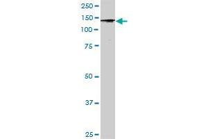 STK36 MaxPab rabbit polyclonal antibody. (STK36 antibody  (AA 1-1315))