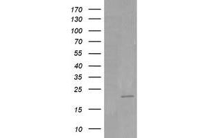 Image no. 4 for anti-HRas proto-oncogene, GTPase (HRAS) antibody (ABIN1498715)