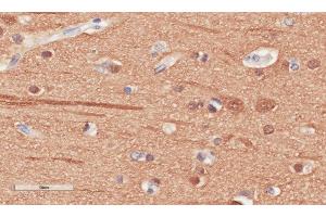 Immunohistochemical staining of human cerebral cortex tissue using anti-Beta Tubulin antibody. (Recombinant TUBB antibody)