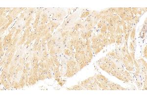 Detection of vWF in Rat Heart Tissue using Polyclonal Antibody to Von Willebrand Factor (vWF) (VWF antibody  (AA 49-230))