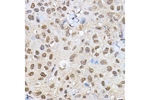 Immunohistochemistry (IHC) image for anti-Ribosomal Protein S6 Kinase, 70kDa, Polypeptide 1 (RPS6KB1) (AA 361-525) antibody (ABIN7270029)