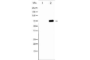 Western blot analysis of Tau phosphorylation expression in MDA-MB-435 whole cell lysates,The lane on the left is treated with the antigen-specific peptide. (MAPT antibody  (pThr231))