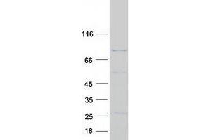 DGKB Protein (Transcript Variant 1) (Myc-DYKDDDDK Tag)