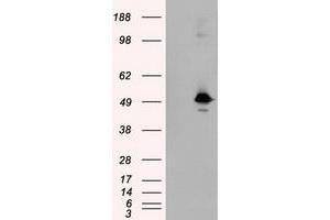 HEK293T cells were transfected with the pCMV6-ENTRY control (Left lane) or pCMV6-ENTRY KIAA1609 (Right lane) cDNA for 48 hrs and lysed. (KIAA1609 antibody)