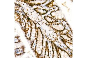 Immunohistochemistry of paraffin-embedded mouse colon using Phospho-POLR2A CTD-S2 Rabbit mAb  at dilution of 1:200 (40x lens).
