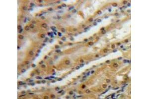 Used in DAB staining on fromalin fixed paraffin-embedded Kidney tissue (SPARC antibody  (AA 18-303))