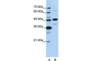Western Blotting (WB) image for anti-Nucleolar Protein 4 (NOL4) antibody (ABIN2462155) (NOL4 antibody)