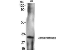 Western Blot (WB) analysis of specific cells using Aldose Reductase Polyclonal Antibody. (AKR1B1 antibody  (C-Term))