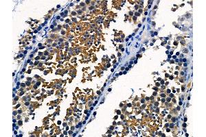 ABIN6265634 and ABIN6266663 at 1/100 staining Mouse testis tissue by IHC-P.