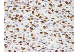 Immunohistochemistry (IHC) image for anti-Heterogeneous Nuclear Ribonucleoprotein H1 (H) (HNRNPH1) (C-Term) antibody (ABIN7448597) (HNRNPH1 antibody  (C-Term))