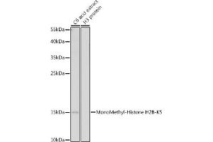 Western blot analysis of extracts of C6 cells, using MonoMethyl-Histone H2B-K5 antibody (ABIN7267735) at 1:500 dilution. (Histone H2B antibody  (meLys5))
