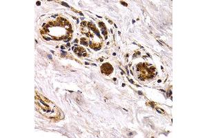 Immunohistochemistry of paraffin-embedded human normal breast using CHI3L1 antibody at dilution of 1:200 (400x lens). (CHI3L1 antibody)