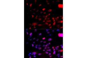 Immunofluorescence analysis of U2OS cells using Phospho-CHEK1-S317 antibody (ABIN5969879). (CHEK1 antibody  (pSer317))