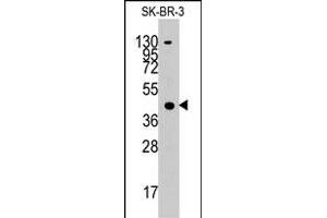 Western blot analysis of ACAT1 polyclonal antibody  in SK-BR-3 cell line lysates (35 ug/lane). (ACAT1 antibody  (C-Term))