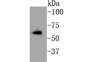 MCF-7 cell lysates probed with Estrogen Receptor alpha(S118) (3A7 ) Monoclonal Antibody  at 1:1000 overnight at 4˚C. (Estrogen Receptor alpha antibody  (pSer118))