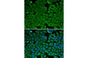Immunofluorescence (IF) image for anti-serine Peptidase Inhibitor, Kazal Type 1 (SPINK1) (AA 24-79) antibody (ABIN6215027)