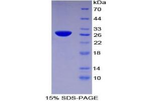 SDS-PAGE analysis of Human TFPI2 Protein.