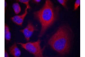Immunofluorescence staining of methanol-fixed Hela cells using ADD1(Phospho-Ser726) Antibody. (alpha Adducin antibody  (pSer726))