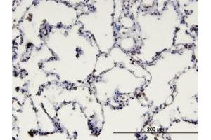 Image no. 1 for anti-Methyl-CpG Binding Domain Protein 1 (MBD1) (AA 415-509) antibody (ABIN599400) (MBD1 antibody  (AA 415-509))