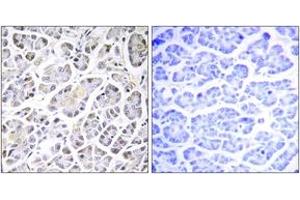 Immunohistochemistry analysis of paraffin-embedded human pancreas tissue, using ATP5G3 Antibody.