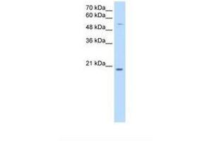 Image no. 1 for anti-Cysteine-Rich Hydrophobic Domain 2 (CHIC2) (N-Term) antibody (ABIN6738276) (CHIC2 antibody  (N-Term))