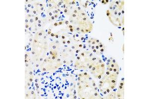 Immunohistochemistry of paraffin-embedded mouse kidney using SET/T antibody (ABIN6131353, ABIN6147631, ABIN6147634 and ABIN6221803) at dilution of 1:100 (40x lens). (SET/TAF-I antibody  (AA 1-277))