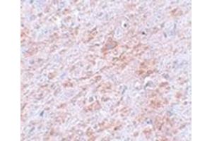 Immunohistochemistry of DLCK2 in rat brain tissue with DLCK2 antibody at 5 μg/ml. (DCLK2 antibody  (C-Term))