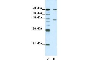 WB Suggested Anti-PABPC4 Antibody Titration:  1. (PABPC4 antibody  (N-Term))