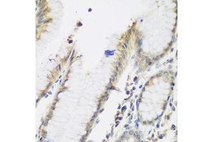 Immunohistochemistry of paraffin-embedded human stomach using NAA50 antibody. (NAA50 antibody  (AA 1-169))