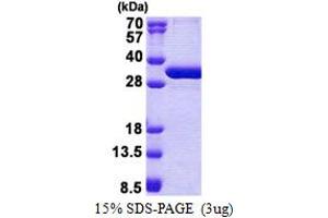 SDS-PAGE (SDS) image for Non-SMC Element 1 Homolog (NSMCE1) (AA 1-266) protein (His tag) (ABIN5853117) (NSMCE1 Protein (AA 1-266) (His tag))