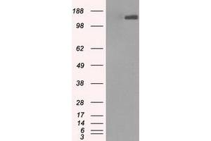 Image no. 1 for anti-L1 Cell Adhesion Molecule (L1CAM) antibody (ABIN1499083) (L1CAM antibody)
