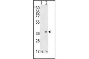 Western blot analysis of HLA-DQA1 (arrow) using HLA-DQA1 Antibody (N-term) Cat. (HLA-DQA1 antibody  (N-Term))