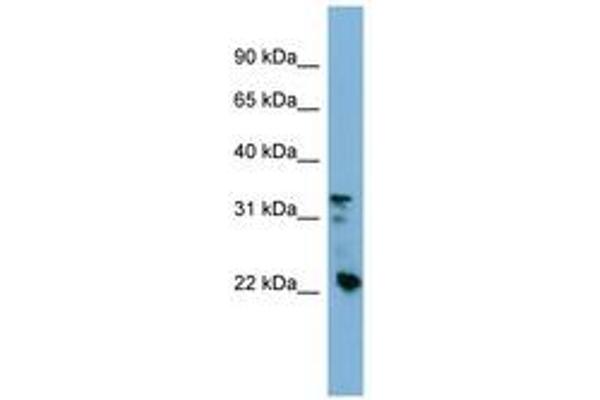 CRYBB3 antibody  (AA 107-156)