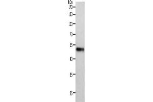 Gel: 10 % SDS-PAGE, Lysate: 40 μg, Lane: Human lung tissue, Primary antibody: ABIN7191459(MIDN Antibody) at dilution 1/1000, Secondary antibody: Goat anti rabbit IgG at 1/8000 dilution, Exposure time: 2 minutes