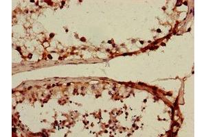 Immunohistochemistry of paraffin-embedded human testis tissue using ABIN7170106 at dilution of 1:100 (SLC15A3 antibody  (AA 253-309))