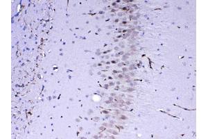 Immunohistochemistry (IHC) image for anti-Mediator Complex Subunit 4 (MED4) (AA 27-140) antibody (ABIN5519029)