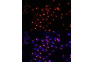 Immunofluorescence analysis of HeLa cells using SGMS1 Rabbit pAb (ABIN7270532) at dilution of 1:100. (Sphingomyelin Synthase 1 antibody  (AA 1-134))