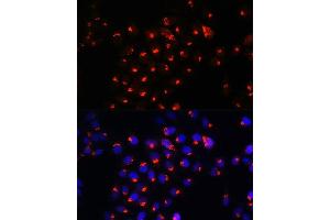 Immunofluorescence analysis of HeLa cells using SGMS1 Rabbit pAb (ABIN7270532) at dilution of 1:100. (Sphingomyelin Synthase 1 antibody  (AA 1-134))
