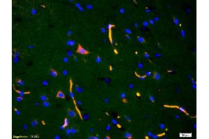 Formalin-fixed and paraffin-embedded rat brain labeled with Anti-ADAMTS7 Polyclonal Antibody, Unconjugated (ABIN672486) 1:200, overnight at 4°C, The secondary antibody was Goat Anti-Rabbit IgG, Cy3 conjugated used at 1:200 dilution for 40 minutes at 37°C. (ADAMTS7 antibody  (AA 241-340))