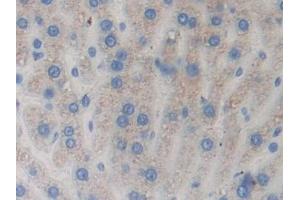 Detection of RNASE3 in Rat Liver Tissue using Polyclonal Antibody to Ribonuclease A3 (RNASE3) (RNASE3 antibody  (AA 33-155))