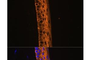 Immunofluorescence analysis of Rat eye using MYH13 Polyclonal Antibody at dilution of 1:100 (40x lens). (MYH13 antibody)
