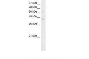 Image no. 1 for anti-Zinc Finger and BTB Domain Containing 3 (ZBTB3) (N-Term) antibody (ABIN6736161) (ZBTB3 antibody  (N-Term))