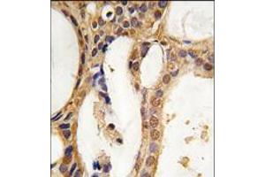 Image no. 1 for anti-Pim-1 Oncogene (PIM1) antibody (ABIN360328) (PIM1 antibody)