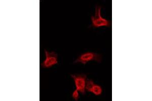 ABIN6266636 staining HuvEc by IF/ICC. (Sodium Channel-Pan antibody)