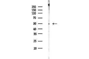 anti-Aldehyde Dehydrogenase 3 Family, Member B1 (ALDH3B1) (N-Term) antibody
