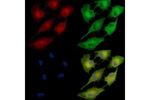 ABIN7095462 and ABIN7099519 staining  cells by IF/ICC. (FAM83B antibody)
