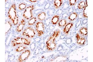 Formalin-fixed, paraffin-embedded human Renal Cell Carcinoma stained with CD137L-Monospecific Mouse Monoclonal Antibody (CD137L/1547). (TNFSF9 antibody)