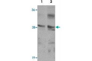 Western blot analysis of TMEM192 in SK-N-SH cell lysate with TMEM192 polyclonal antibody  at (1) 0.