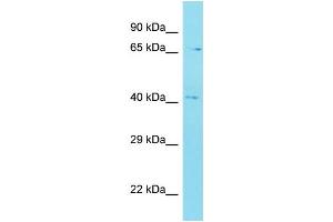 Host: Rabbit Target Name: C12orf56 Sample Type: MDA-MB-435S Whole Cell lysates Antibody Dilution: 1. (C12orf56 antibody  (N-Term))